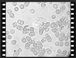 Phagocytosis occuring