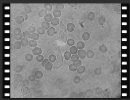 Too Many phagocytes